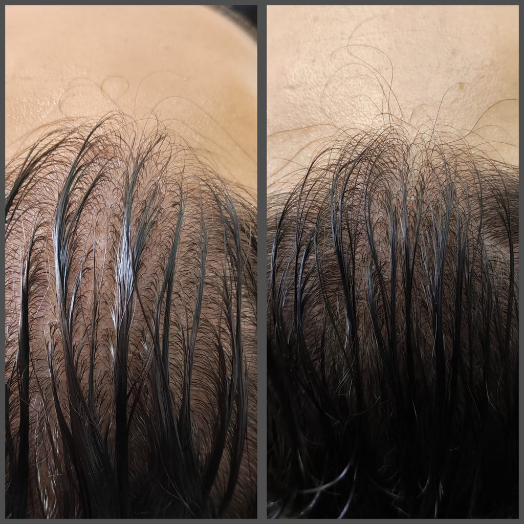 Royal Bloom Hair Growth Duo